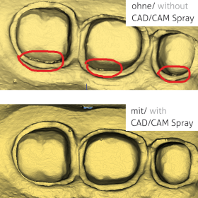 Zahnmodell-Aufnahme mit und ohne TOPDENT CAD/CAM-Spray